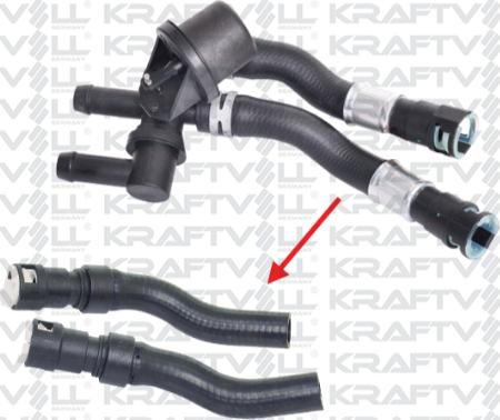 KRAFTVOLL 10032419 - Шланг радіатора autozip.com.ua